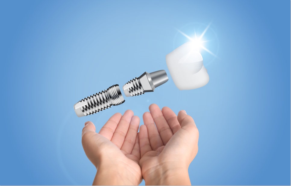 정밀 진단 이미지