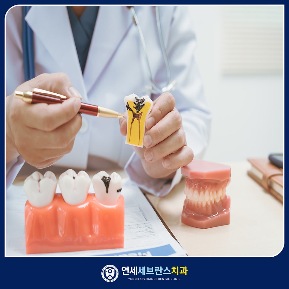 레진 충치치료 이미지