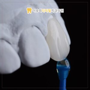 Read more about the article 온천장미니쉬로 치아 손상 줄이기: 효과적인 치료 방법