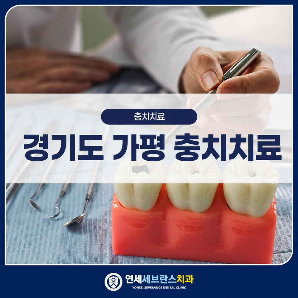 Read more about the article 경기도 가평 충치치료, 치아가 썩는 원인과 단계별 진료 방법