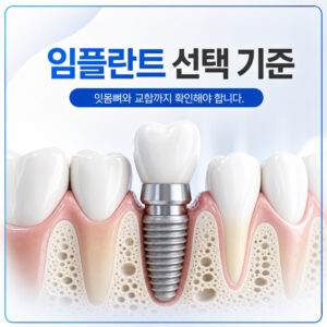 Read more about the article 임플란트 잘하는 치과를 판단하는 치아상식