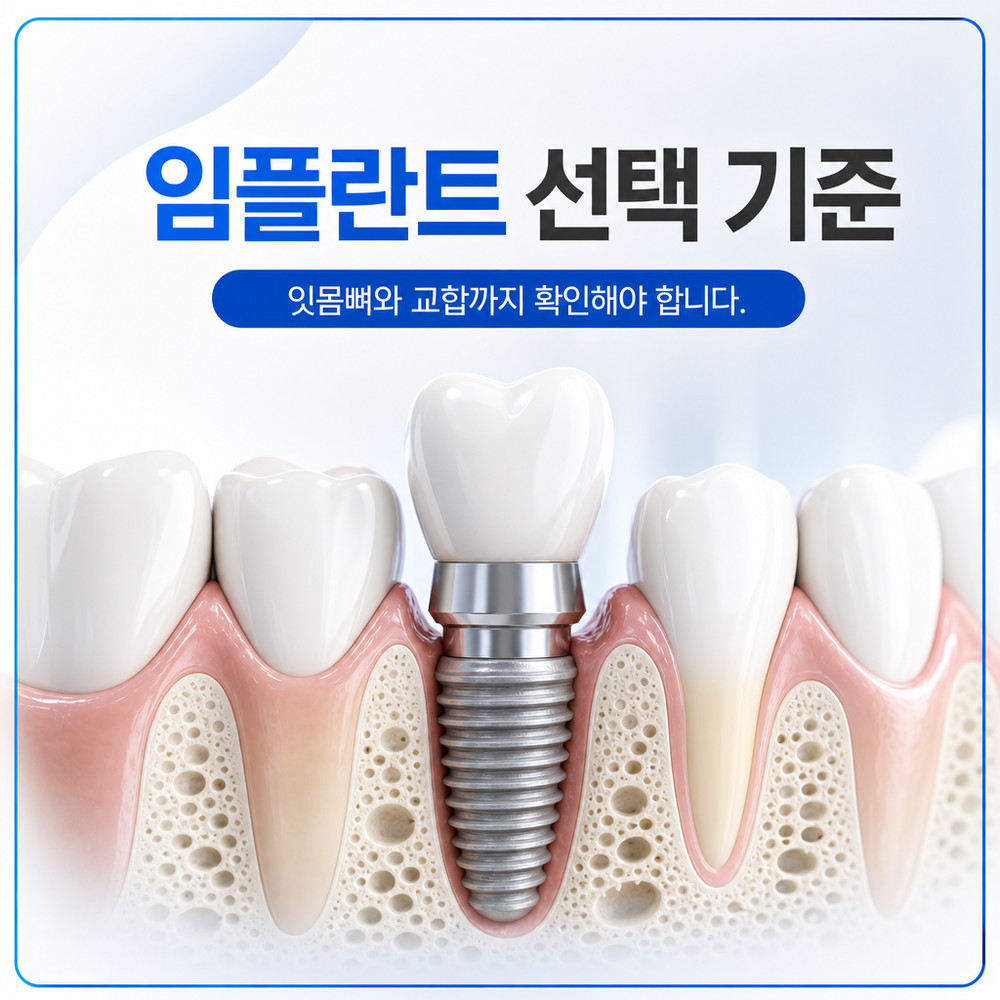 Read more about the article 임플란트 잘하는 치과를 판단하는 치아상식