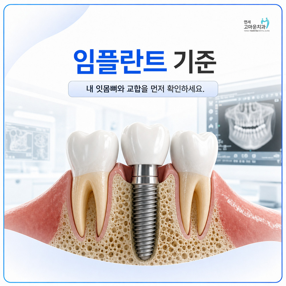 Read more about the article 치아상식: 임플란트 잘하는 치과를 판단하는 기준