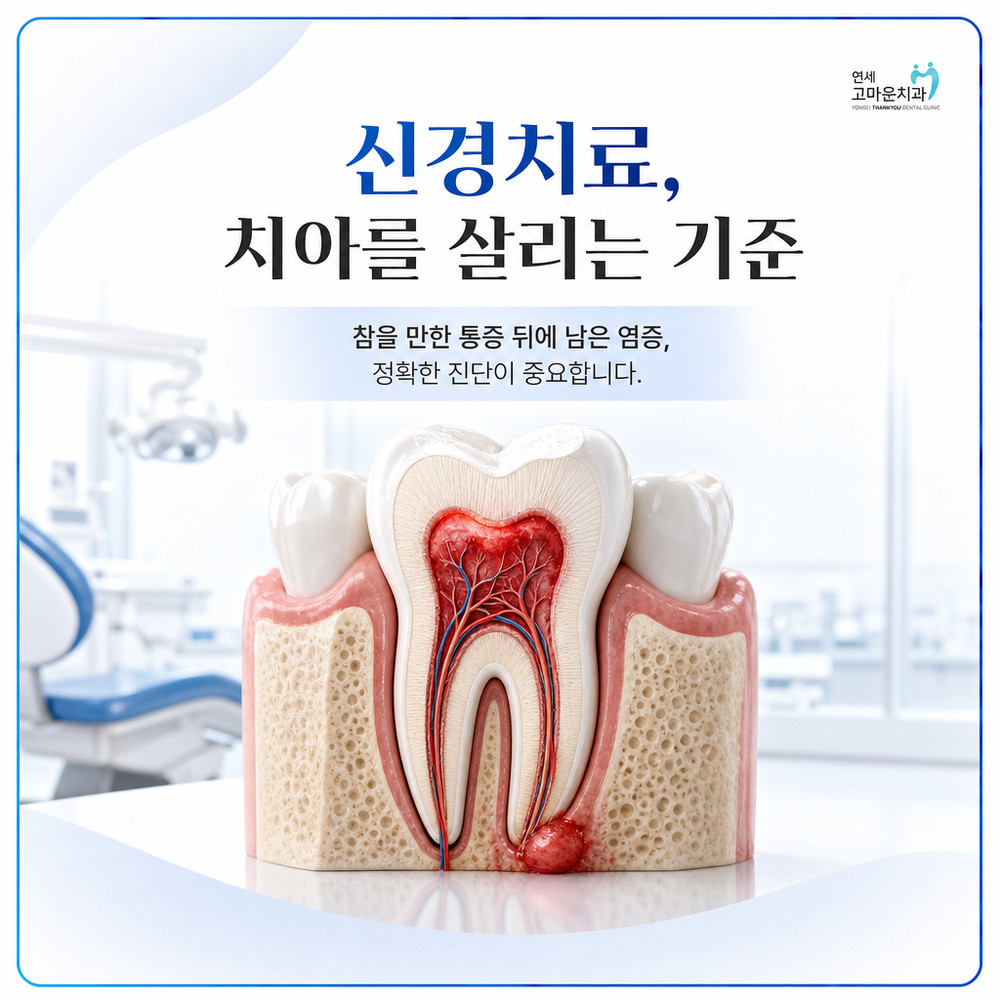 Read more about the article 나성동신경치료 자연치아를 보존하기 위한 마지막 수단