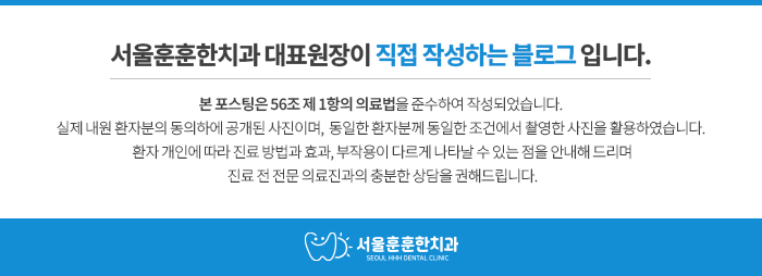 Read more about the article 골다공증 주사 임플란트, 장기투여 하신 고령자분 수면마취치료로 안전하게 치료한 방법