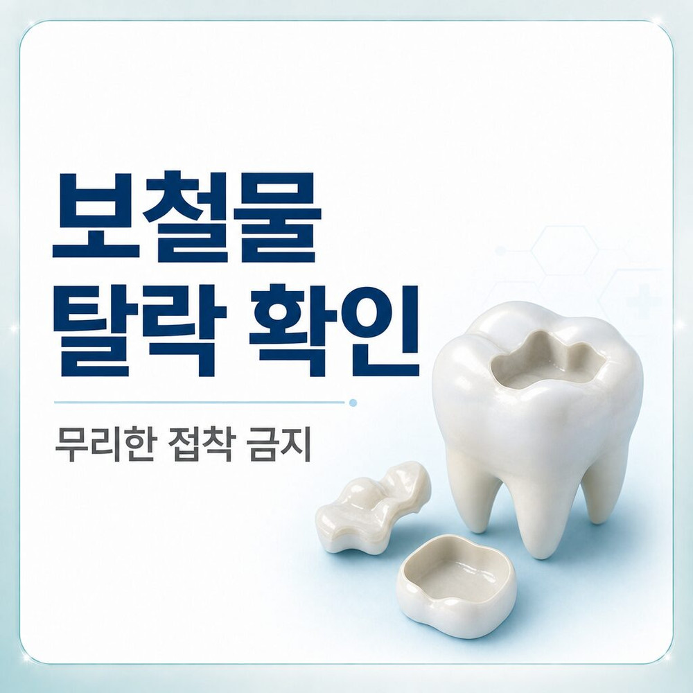 Read more about the article 원업치과: 인레이, 보철물 탈락 시 우선적으로 확인해야 할 부분