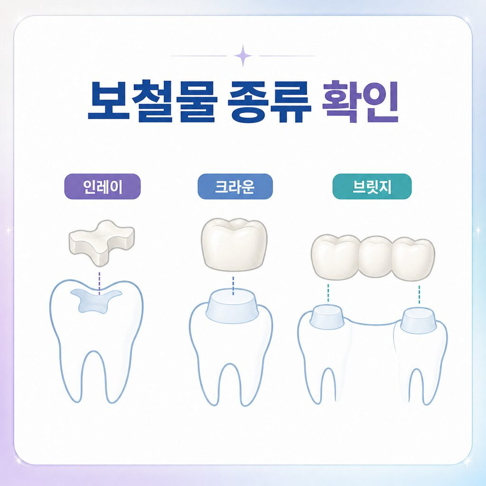 원업치과 보철물 탈락 원인 접착 문제 충치 치아 파절 맞물림 변화 진료 확인