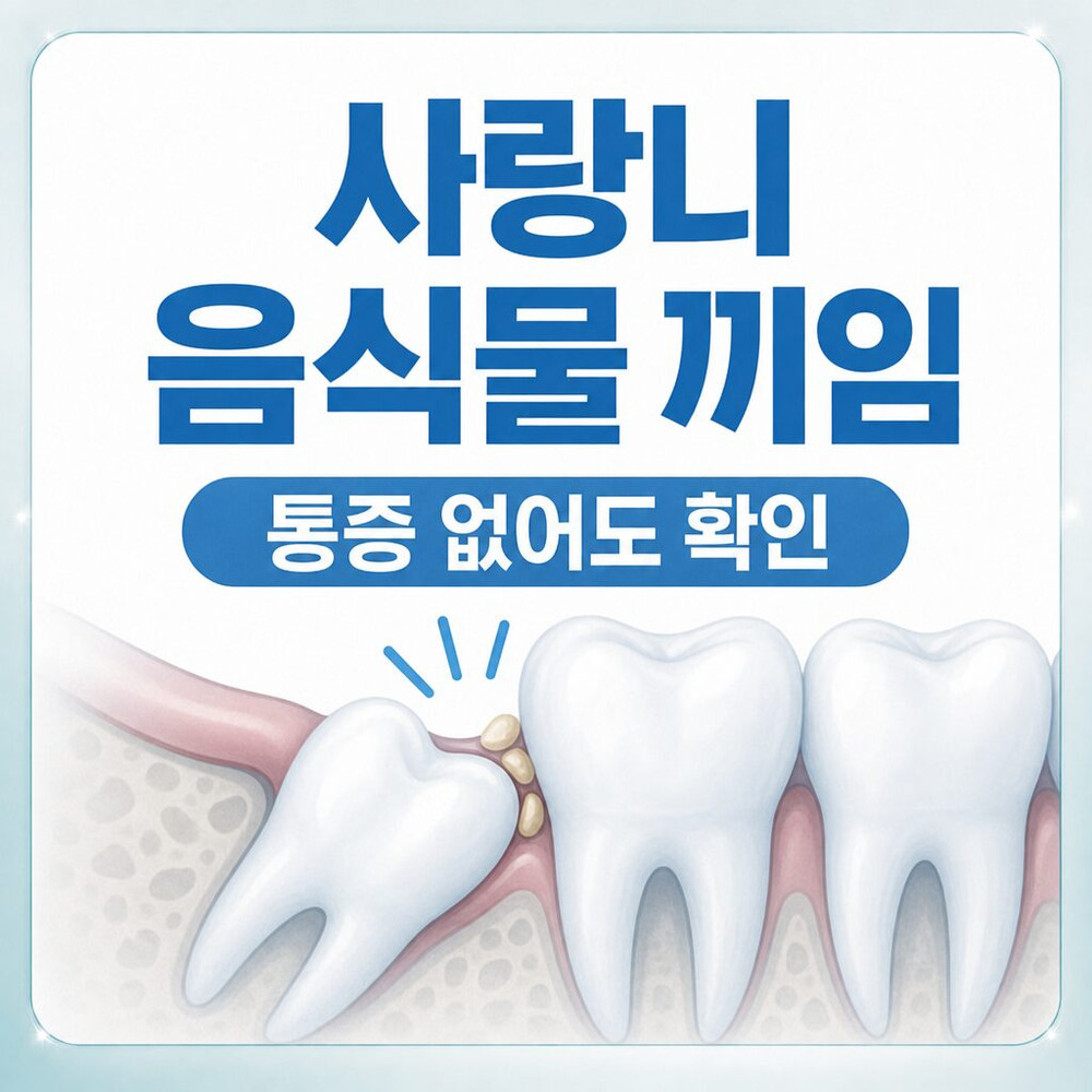 Read more about the article 서울치과 사랑니발치, 통증 없이 음식물이 자주 끼는 이유