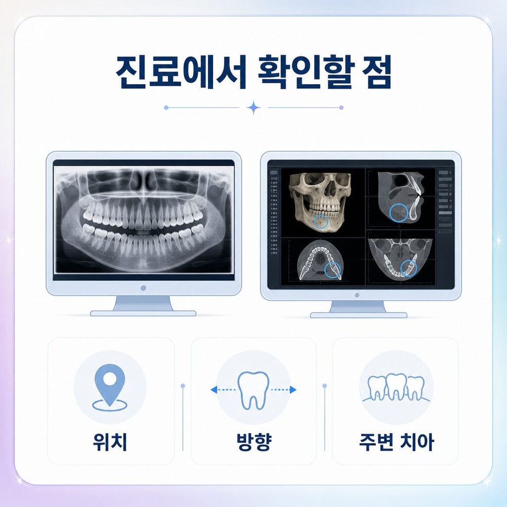 서울치과 사랑니 주변 양치 후 빠지는지 살피는 집 관리 냄새 붓기 반복 여부 점검