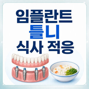 Read more about the article 서울치과 상담 전, 부모님 임플란트 틀니 장착 후 편안한 식사를 위한 적응 방법