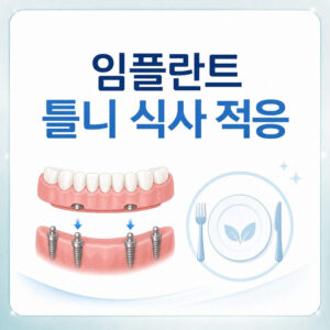 Read more about the article 서울치과 부모님 임플란트 틀니 장착 후 편안한 식사를 위한 적응 방법