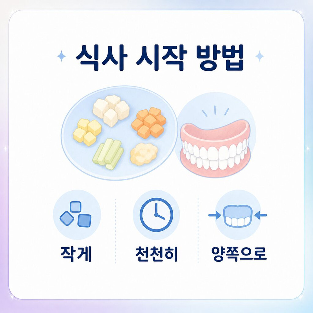 서울치과 상담에 필요한 임플란트 틀니 통증 흔들림 기록 기준 식사 후 확인