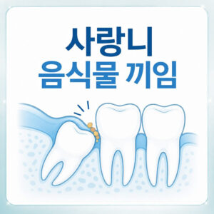 Read more about the article 서울치과 사랑니발치, 통증 없이 음식물이 자주 끼는 이유
