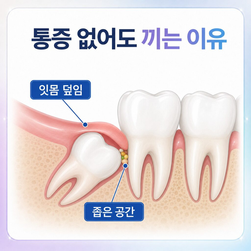 서울치과 사랑니 방향 잇몸 상태 충치 여부 관리 가능성 검사와 발치 판단 진료 과정